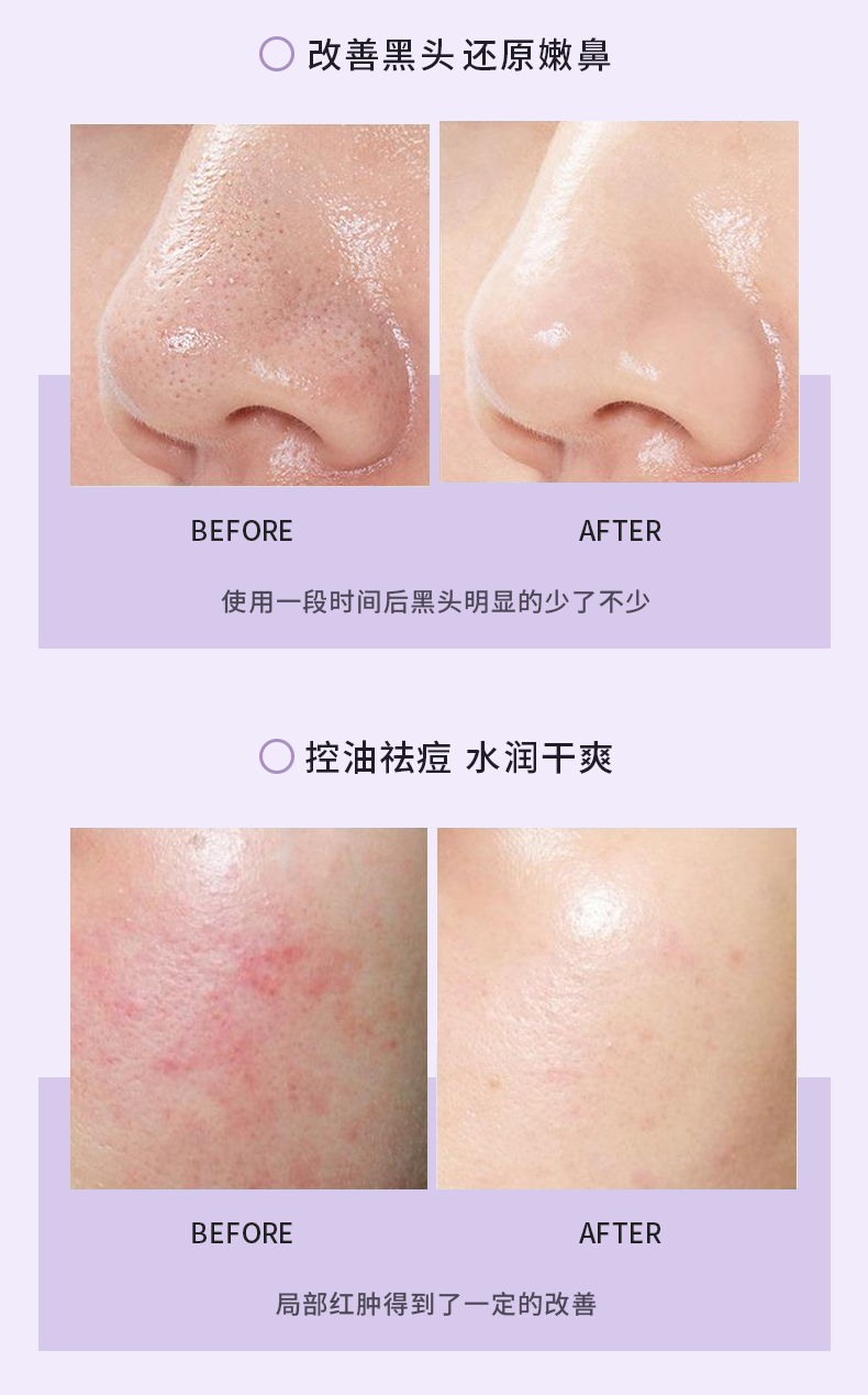 清肌净颜泥膜棒_12.png